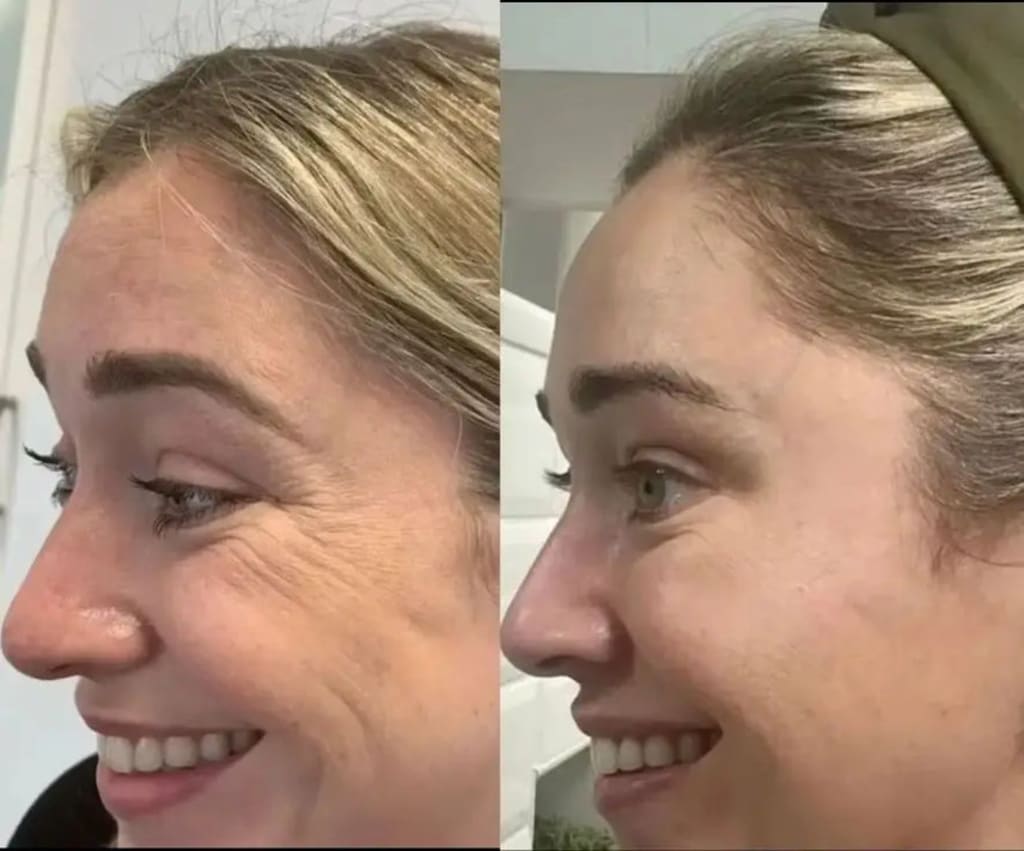 Youthful Glow