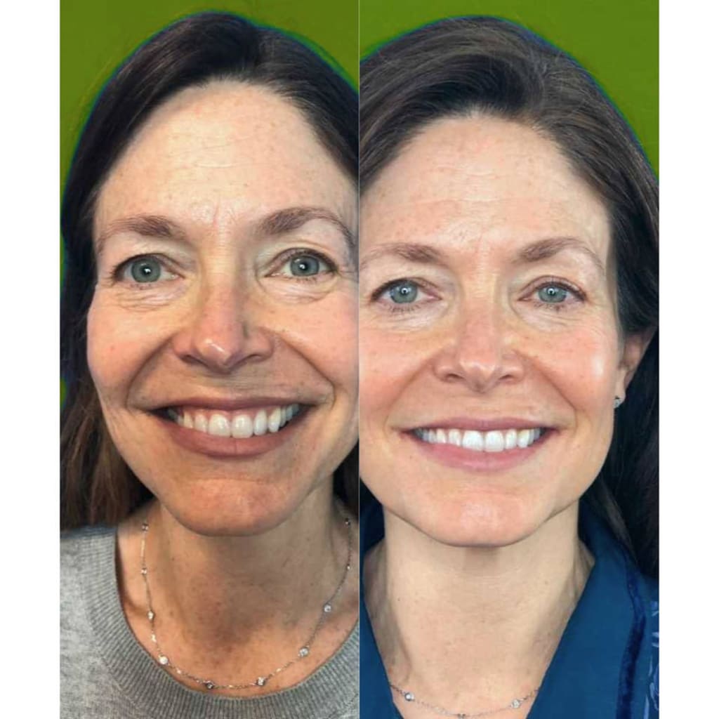 Youthful Glow
